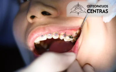 Breketai, Ortodontas ir Osteopatas: kaip pasiruošti sėkmingam dantų tiesinimui